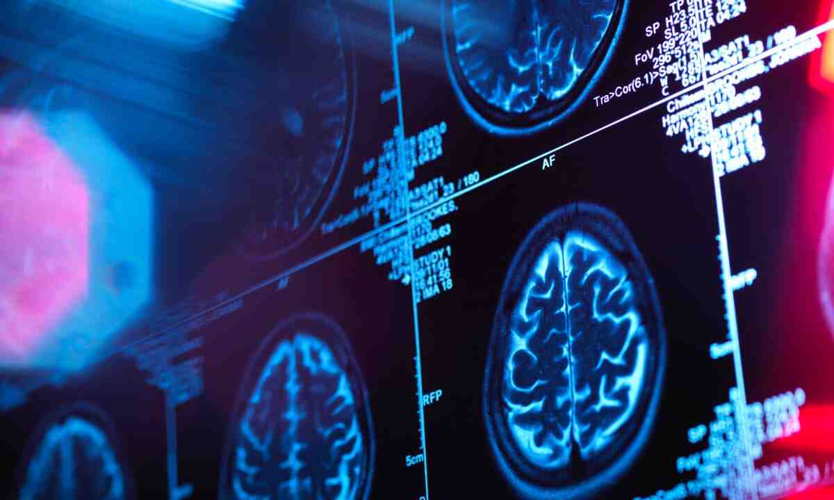 Lee más sobre el artículo Ministerio de Salud: una vida saludable reduce el riesgo de demencia
